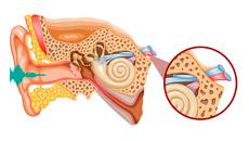 Неврит слухового нерва